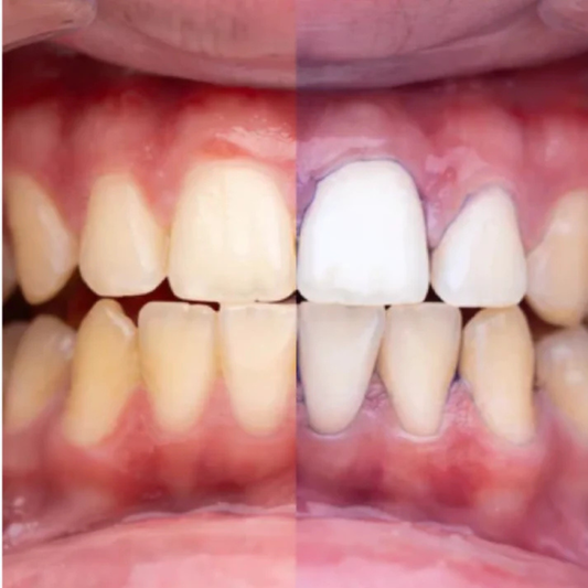 Blanqueador V34 GLUMI