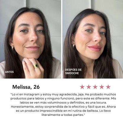 Voluminizador de Labios